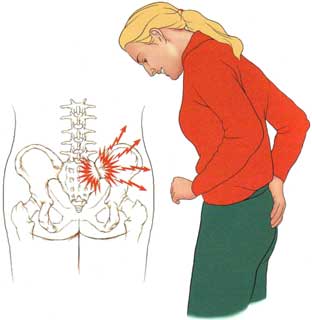 دکتر حسین ارجمند, مفصل ساکروایلیاک , کمر درد, شیراز, متخصص طب فیزیکی و توانبخشی,sacroiliac joint dysfunction