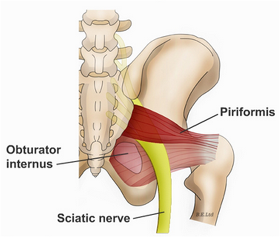 دکتر حسین ارجمند, پیریفورمیس,piriformis syndrome, شیراز