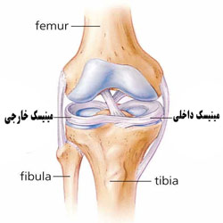 مینیسک (Meniscus)