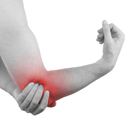 ارنج تنیس بازان (tennis elbow or lateral epicondylitis)