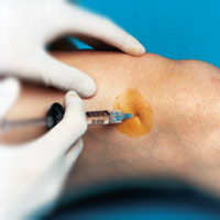 تزریقهای داخل مفصلی (Intraarticular injections)